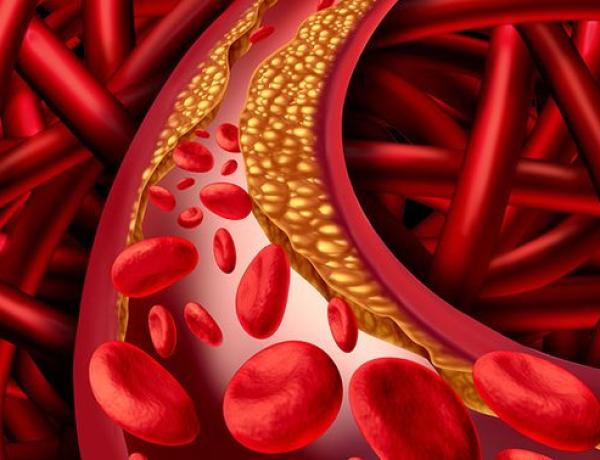 5 Buah Penurun Kolesterol Tinggi yang Perlu Dikonsumsi Secara Rutin